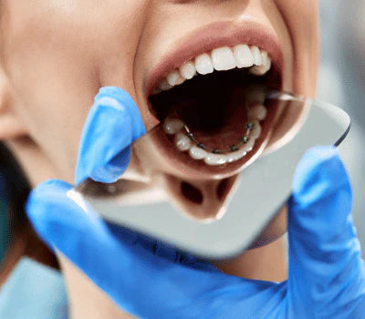 Lingual Braces cost in New York