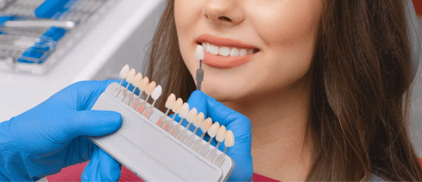 veneers for straighter teeth