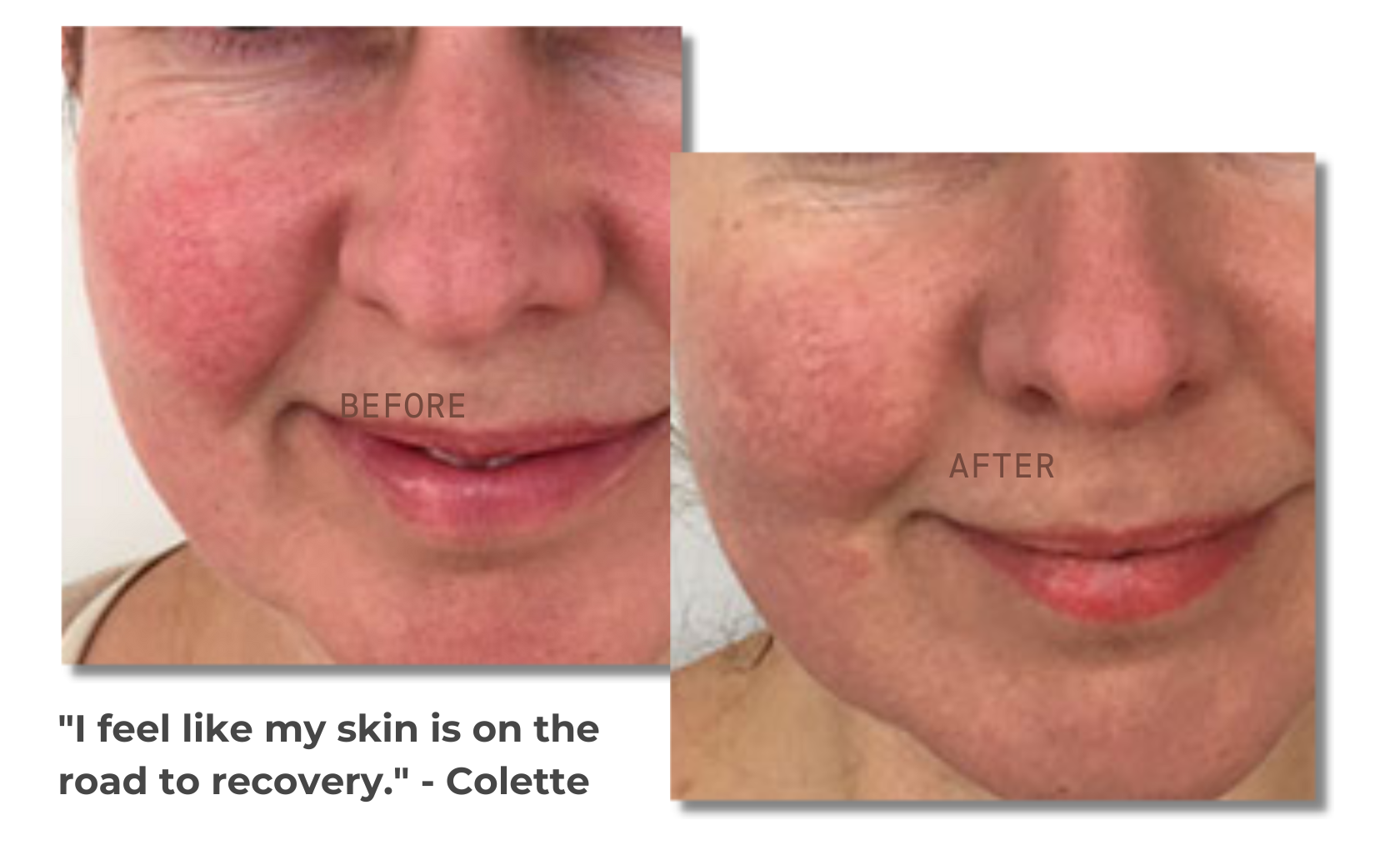 Testimonial from Colette