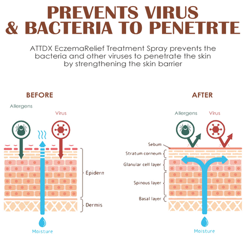 ATTDX EczemaRelief Treatment Spray