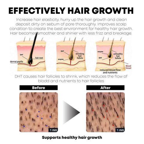 ATTDX HairRegrowth Rice Essence ShampooBar