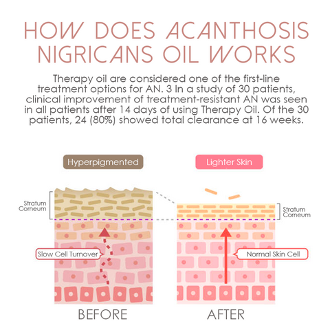 ATTDX Lightens AcanthosisNigricans TherapyOil