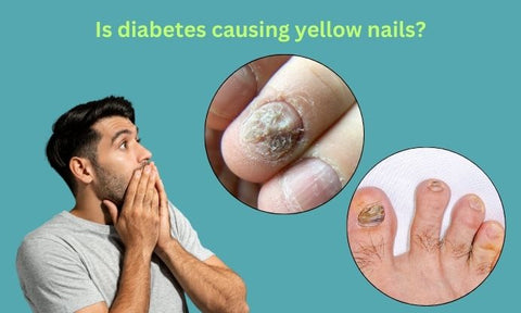 Is diabetes causing yellow nails
