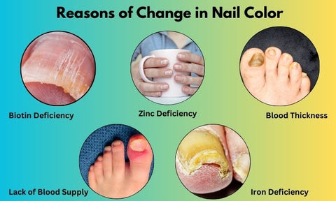 Reasons of change in nail color