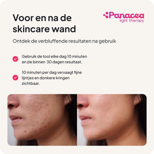 Panacea Skincare Wand Huidverjongingsapparaat Red Light Therapy - Facelift Apparaat Rood Licht Therapie Face - 55fef405af87381cef03cbcad7995df78ca3ceb5_Enriched_product_image