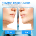 Nuvance - Kaaklijn trainer (Beginner Versie) - Jawline Trainer - Kaak Trainer - Incl. eBook - 5ddecf85b17fff76da61c77afdcce01e575548fb_Enriched_product_image_ab0c10d9-717c-4058-aa93-06d1fa0efdda