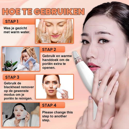 TibaGoods Mee-eters - 6 Opzetstukken - USB - Wit/Zwart - Oplaadtijd 1.5 uur - ab8141a732ef17c6eed5e629f5bf955f00a10584_Enriched_product_image
