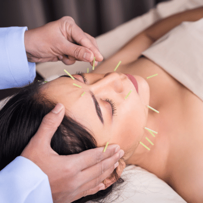 The image shows a woman receiving acupuncture treatment indoors. The woman's skin, cosmetics, and nails are visible as she undergoes the procedure.