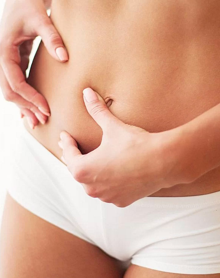 miniabdominoplastia