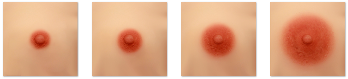 Areola Size.png__PID:7cec0607-c3c9-4eba-92d2-7bd4183dca31