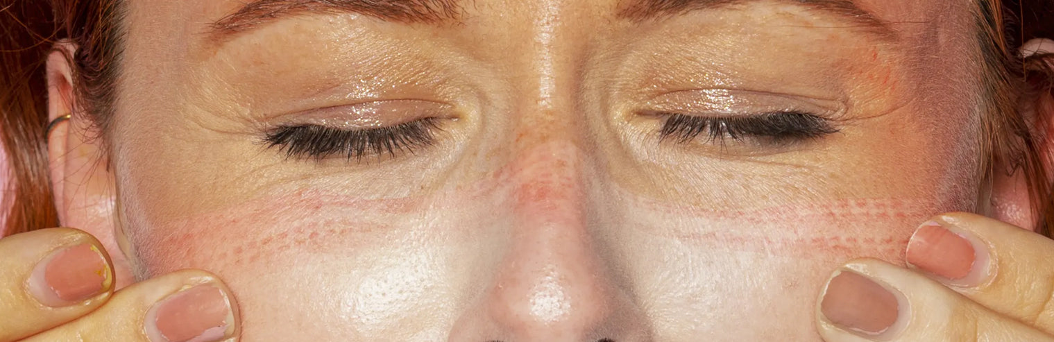 How to Remove Tan from Face