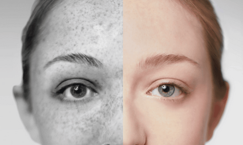 El secreto de una piel limpia y sin imperfecciones: Desvelando el