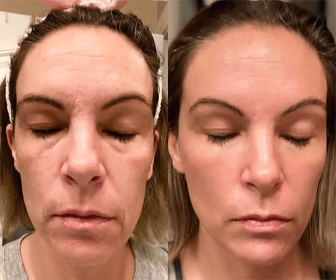 Comparison of skin surface after doing face massage regularly and before doing facial massage 