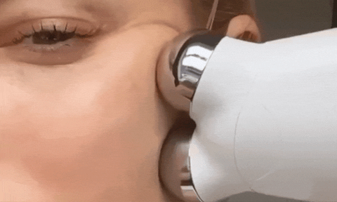 Face Shaper Electrical Massage Tool - MicroRoller