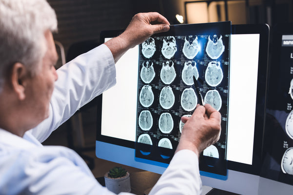 A photo of an X-Ray indicating concussion and CTE in Martial Arts and Combat Sports