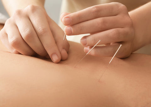 Acupunctuur therapie spierweefselherstel