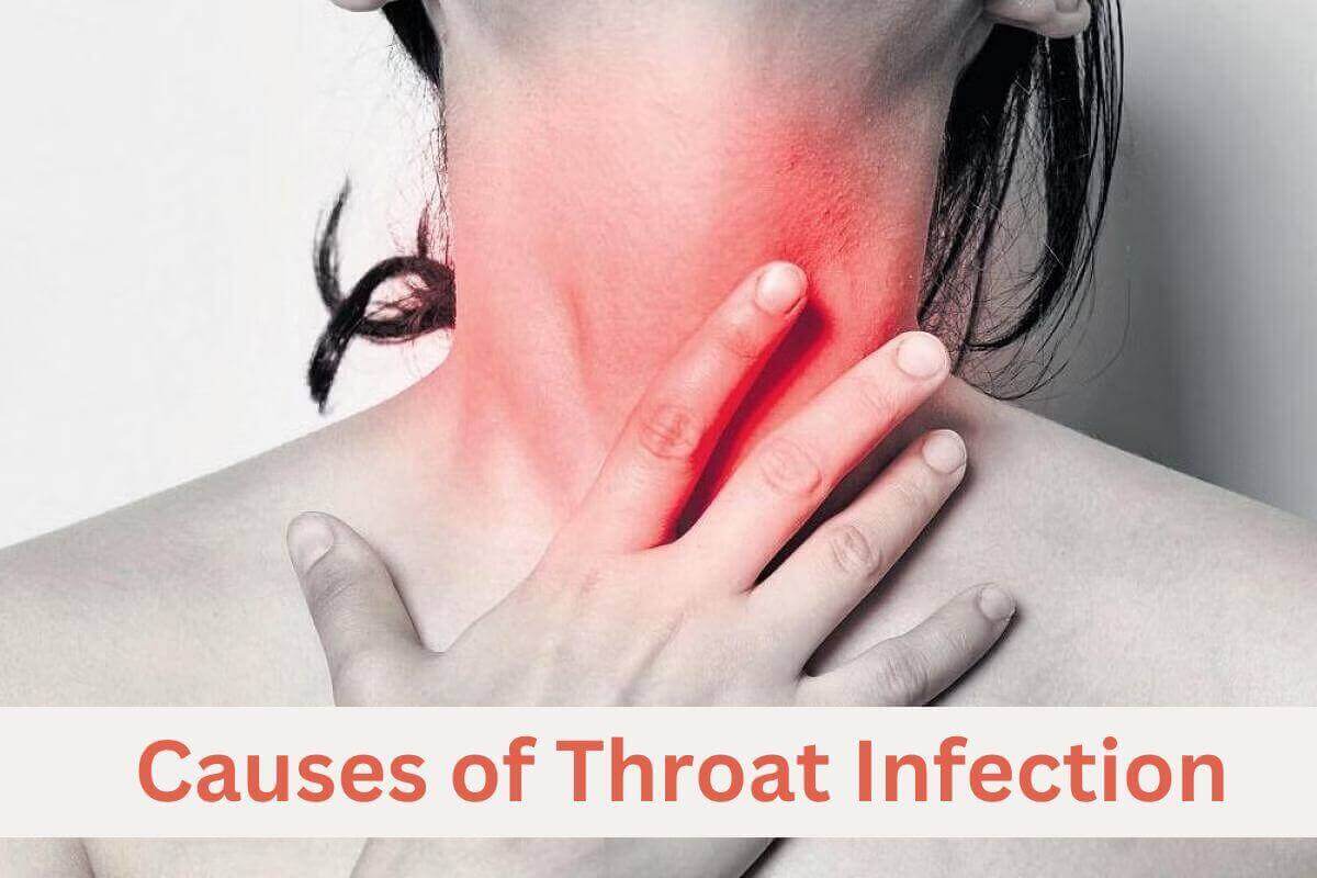 Causes of throat infection