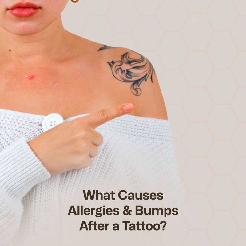 Why Do Tattoo Allergies Happen