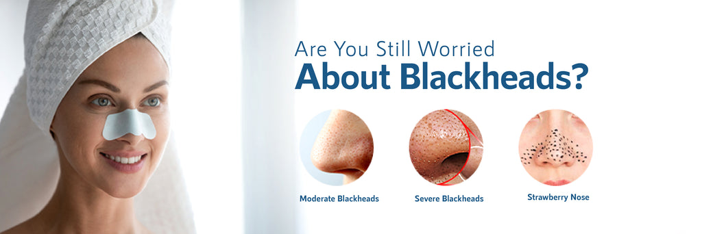 are you worried about blackheads - infographics