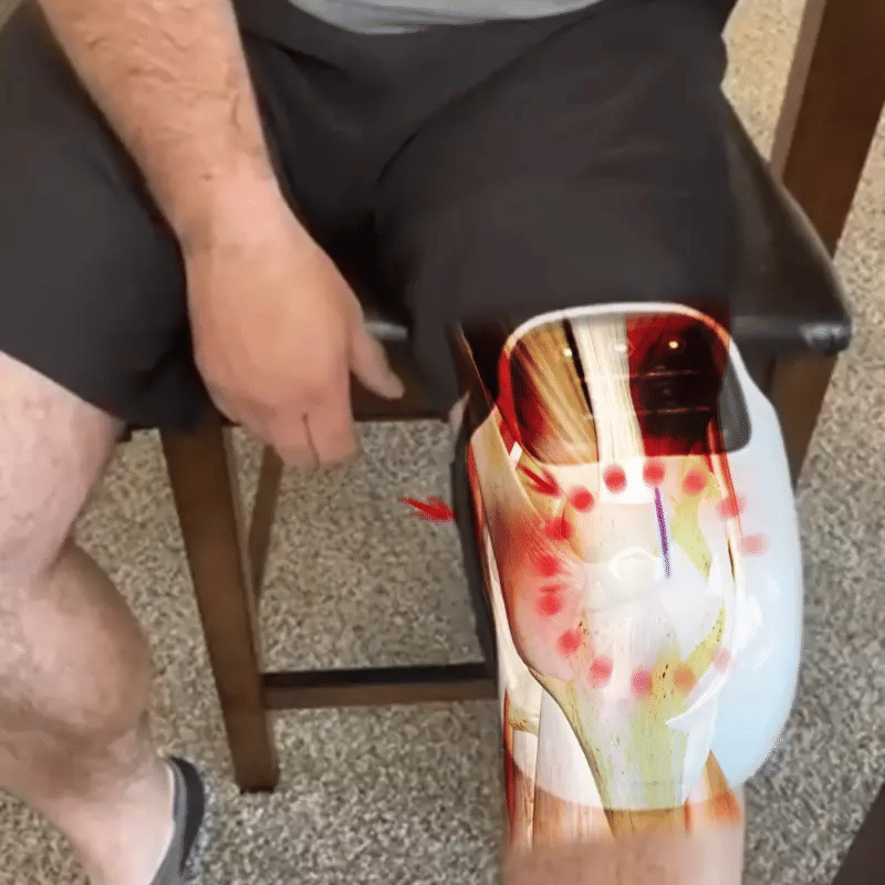 Knee Relax - Joelheira Elétrica Inteligente 4 em 1 Para Massagem
