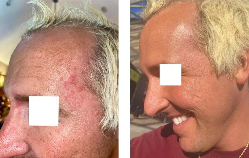 before and after 14