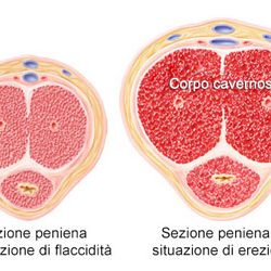 Disfunzione Erettile e Psiche