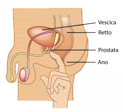 esplorazione rettale