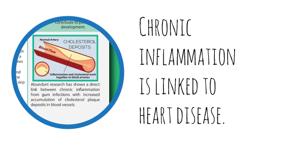 Link between chronic inflammation and heart disease