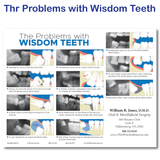 The Problems With Wisdom Teeth