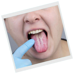 Le gratte langue pour renforcer son système immunitaire, lutter contre l’halitose ou la mauvaise haleine découvrez les bienfaits et avantages qu’offrent l’utilisation du gratte-langue Helly White.
