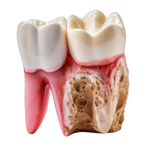Tooth Decay and Gum Disease.webp__PID:7f9265ec-b8d2-4a18-b3fc-81463934e2b0