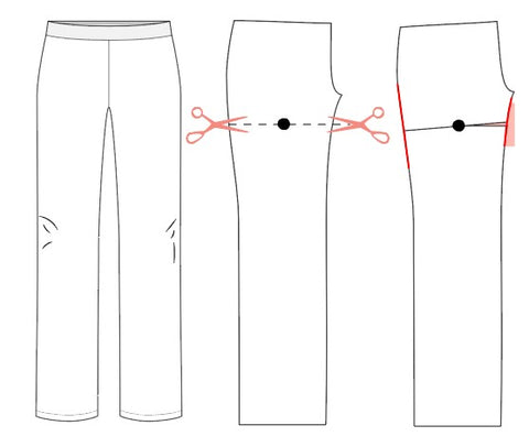 Graphic image illustrating knock knee adjustment