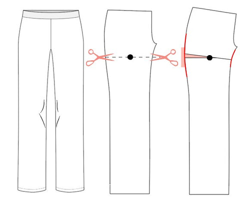 Graphic image illustrating bow legged adjustment
