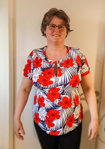 image of person wearing a floral print top