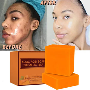 100G Kojic Acid Soap Kit Facial Cleaning Pores Dirt Acne Blackhead Anti-Acne Remove Deep Cleaning Oil Control Whitening Skin - deriluja 