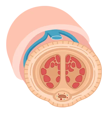 Vasodilation increases blood flow and the 
permeability of blood vessels