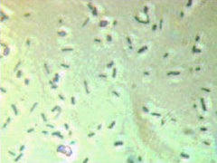 Photo showing Cells of Escherichia coli K-12 grown in non-activated medium