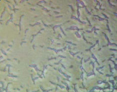 Photo of Cells of Escherichia coli K-12 grown in MRET-activated medium