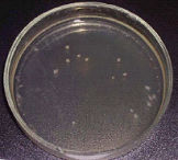 Petri dish of bacteria control