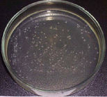 Petri Dish bacteria experiment