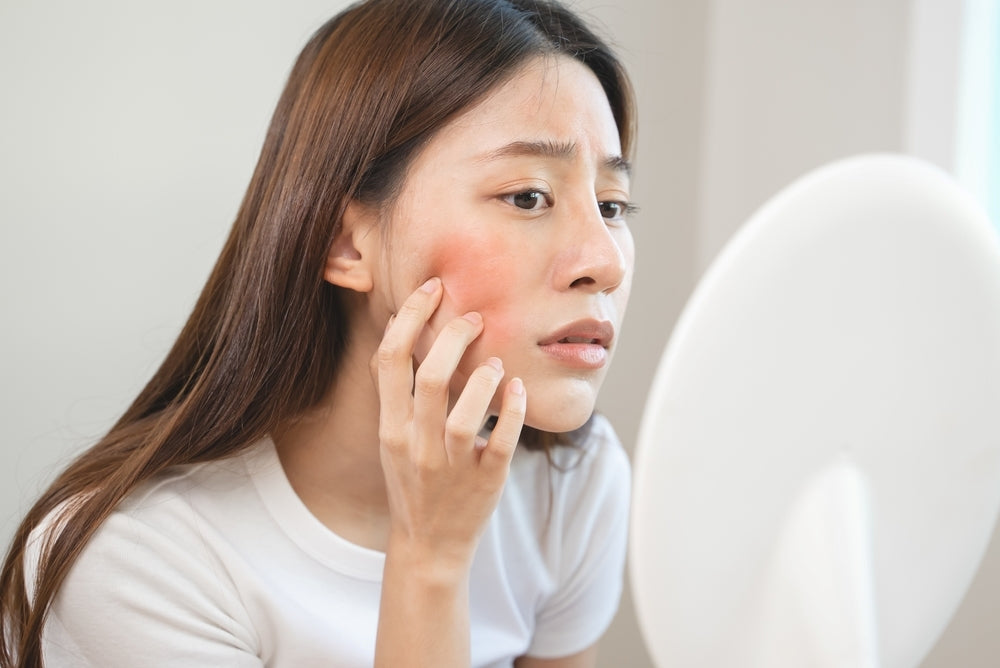 ゼオスキンで赤みや皮むけはいつまで続く?原因と注意点をチェック