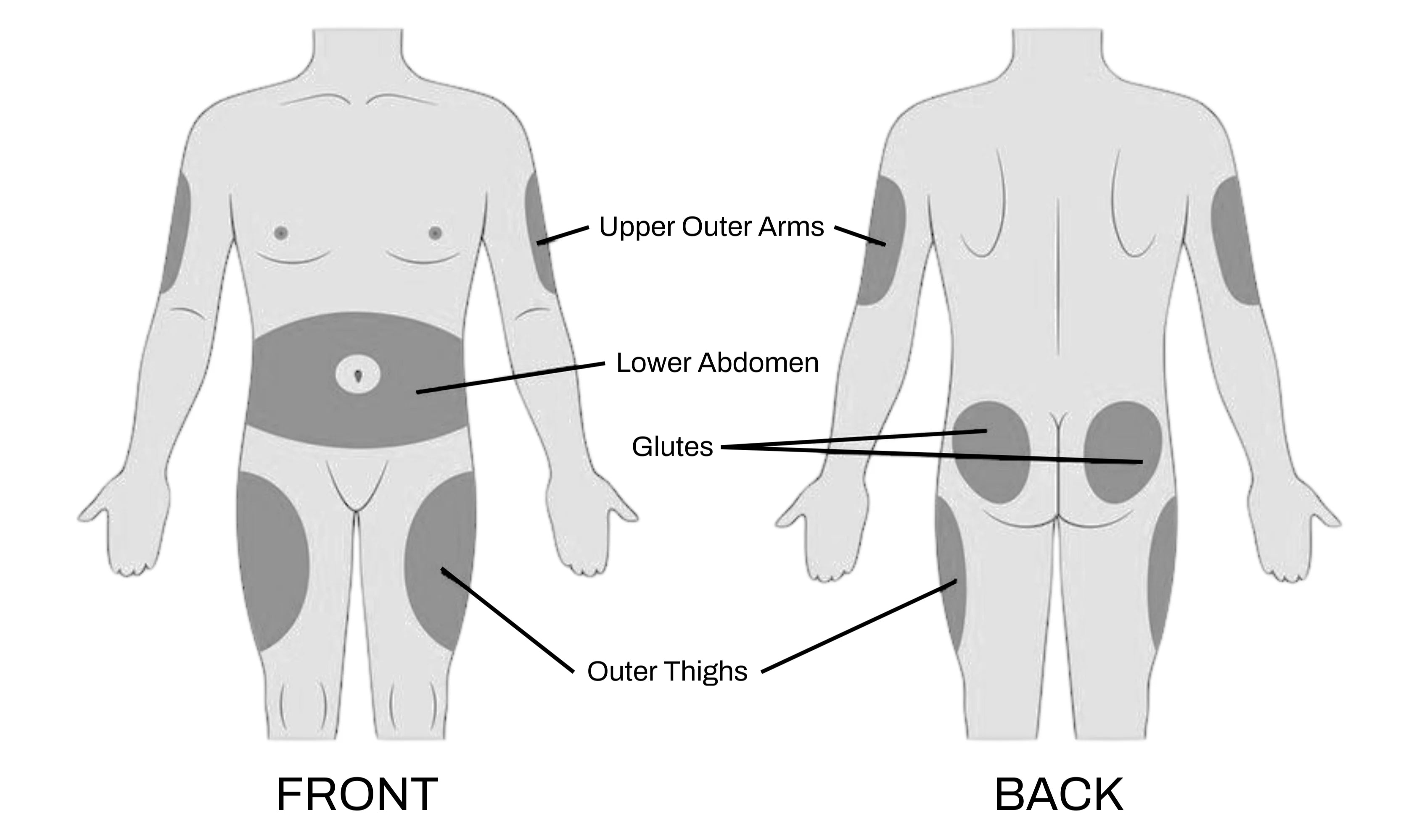 Injection site locations