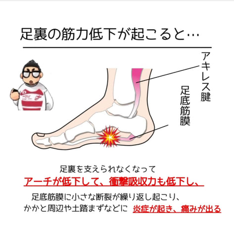 足底筋膜炎の原因