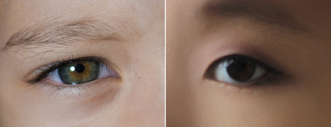 LIDS BY DESIGN: Get Instant Eyelid Lift Without Surgery by Britain  ContoursRx - Issuu