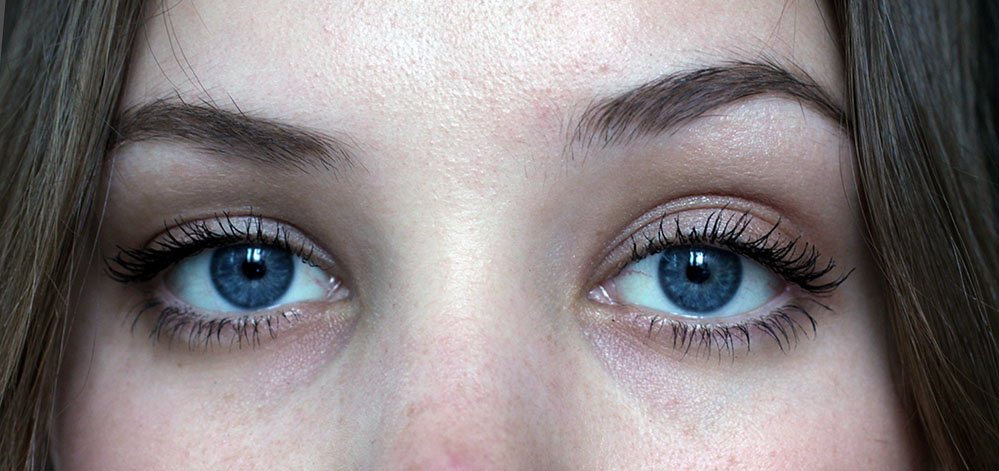 how to fix uneven eyelids