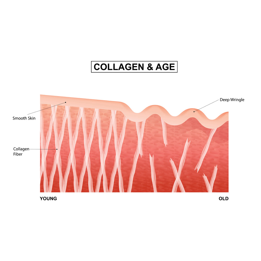 COLLAGEN DETERIORATION WITH AGE
                        