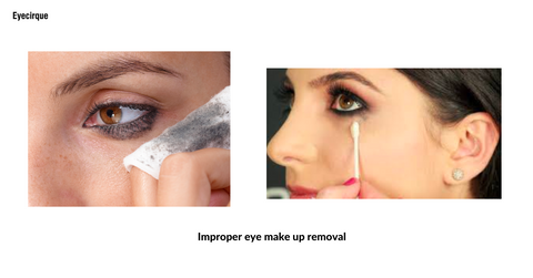 Improper eye make up removal can leads to dark circles