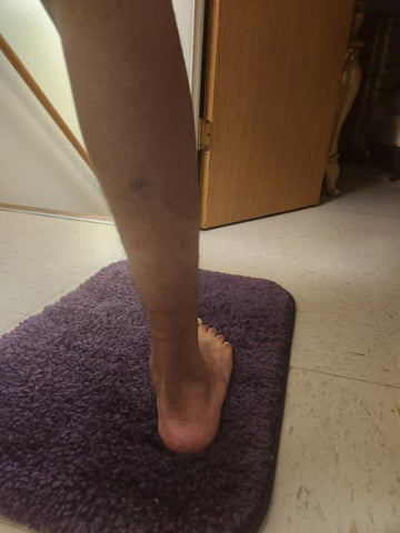 CRPS Leg , CRPS Muscle Atrophy