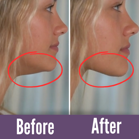 「舌を上げて平らにして二重あごを整える」テクニックを実演する画像。あごのたるみを軽減し、顔の調子を改善する方法を強調しています。
