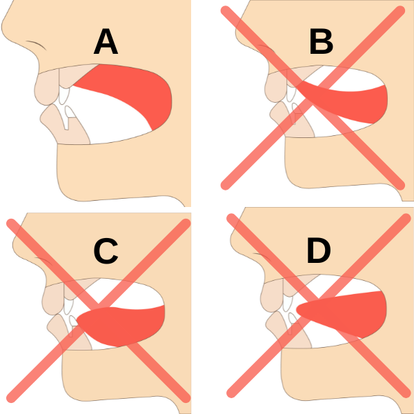 Image illustrating 'Mewing Tongue Posture', demonstrating correct tongue alignment against the palate to enhance facial structure and oral health-1